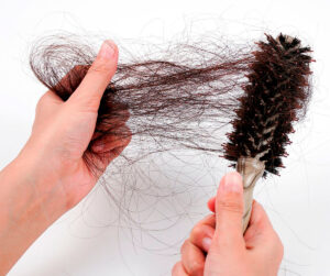 Leia mais sobre o artigo Queda de Cabelo Pós COVID-19