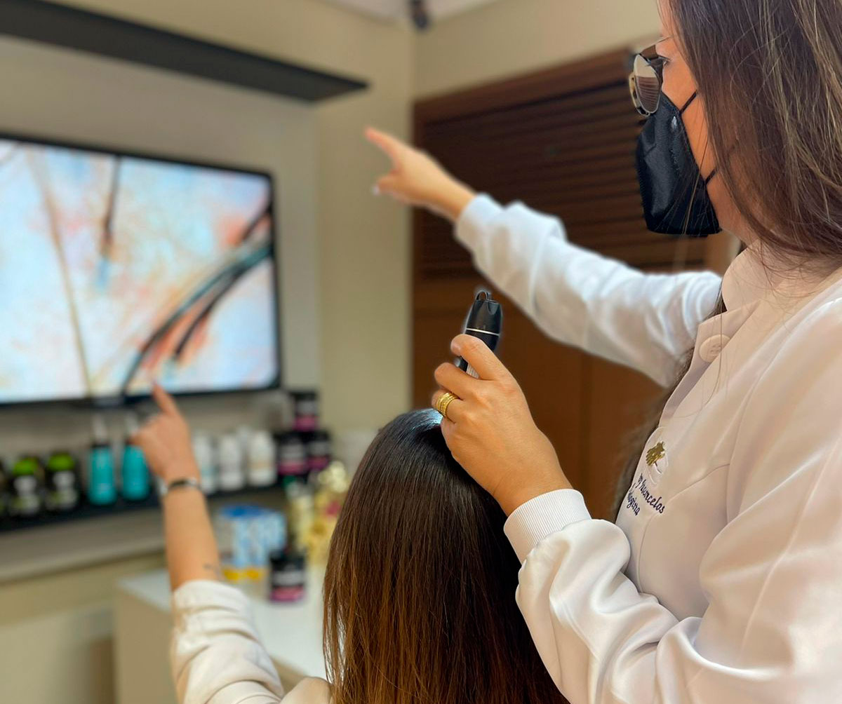 Leia mais sobre o artigo Queda Capilar em Mulheres