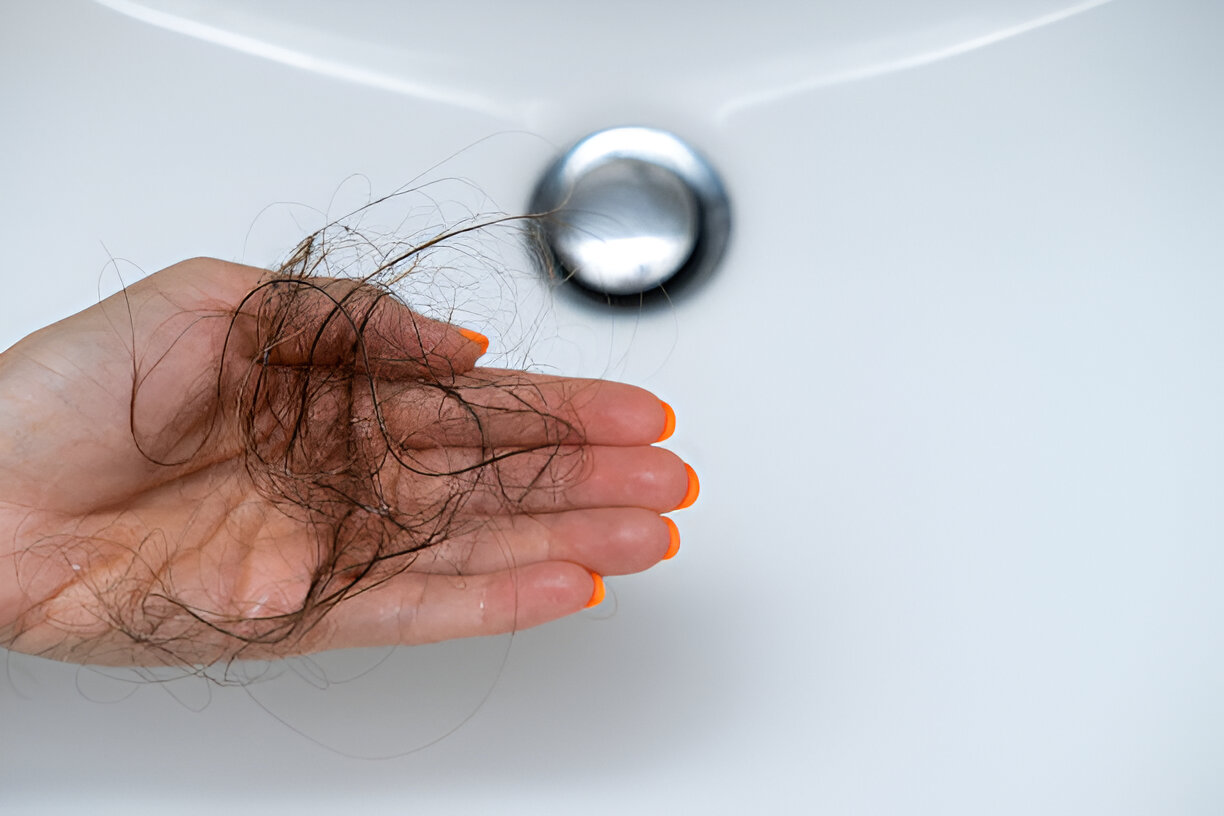Leia mais sobre o artigo Queda de Cabelo: Quando Se Preocupar e Procurar Ajuda