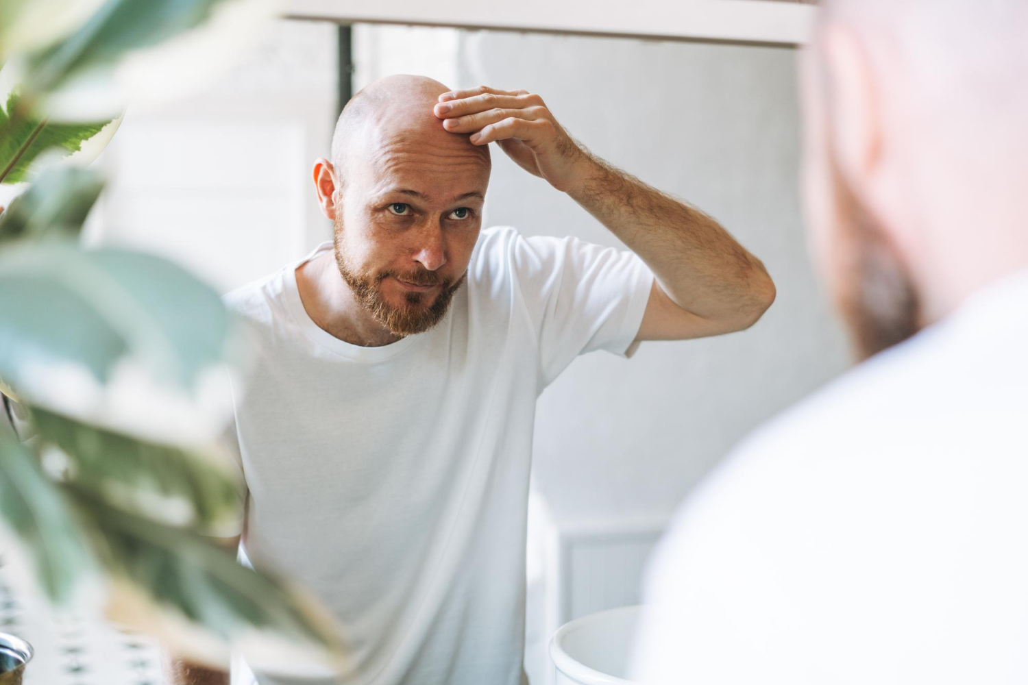No momento, você está visualizando Estou Ficando Careca: O que fazer?